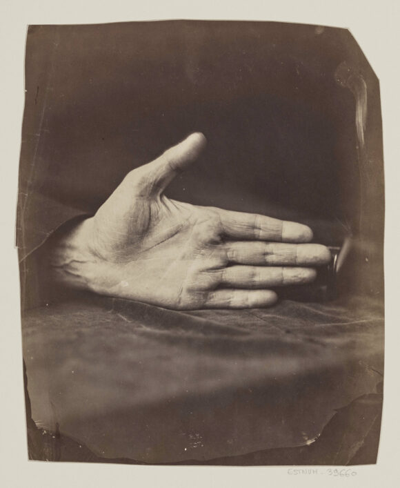 Félix Nadar, Main du banquier « cliché obtenu à la lumière diurne. Epreuve tirée à la lumière électrique », 1861 BnF, département des Estampes et de la photographie