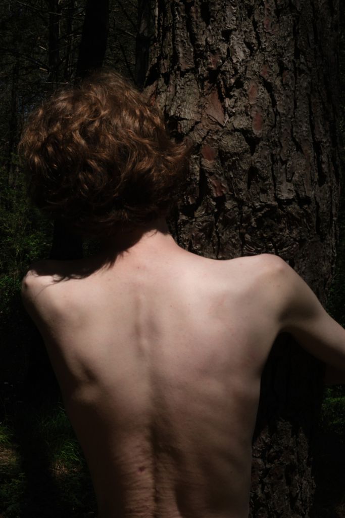 Photographie de Thor Emiroglu montrant un homme enlaçant un arbre.