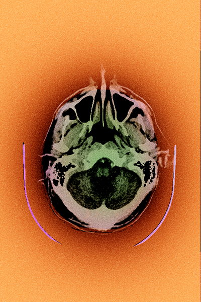 coupe du cerveau humain