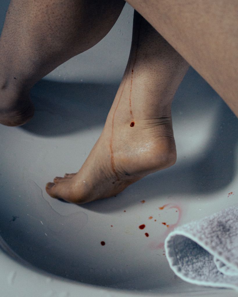 Photographie de Valentina Luraghi montrant du sang perlant sur une jambe